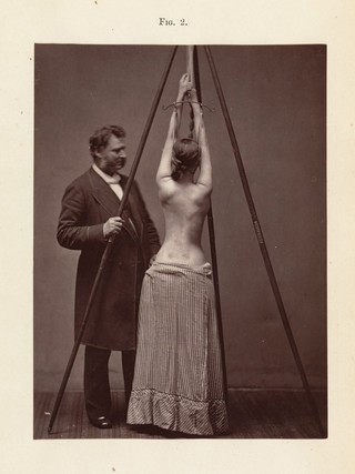 Spinal disease and spinal curvature : their treatment by suspension and the use of the plaster of Paris bandage / by Lewis A. Sayre.