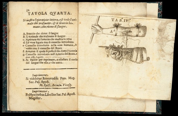 Ragguaglio degl'esperimenti ... circa la nuova operatione della trasfusione del sangue da individuo ad individuo, ed in bruti ed in huomini / [Paolo Manfredi].