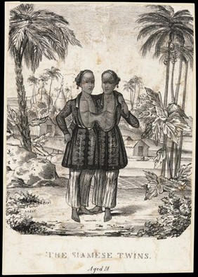 Chang and Eng the Siamese twins, in an oriental setting. Lithograph, ca. 1830.