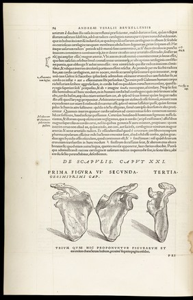 Andreae Vesalii Bruxellensis, scholae medicorum Patauinae professoris De humani corporis fabrica libri septem.