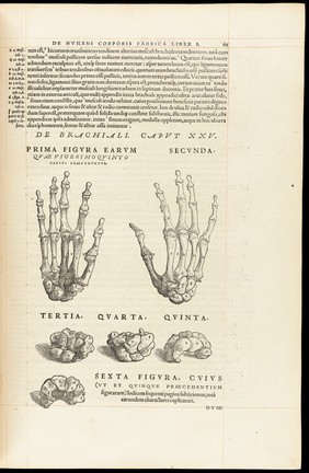 Andreae Vesalii Bruxellensis, scholae medicorum Patauinae professoris De humani corporis fabrica libri septem.