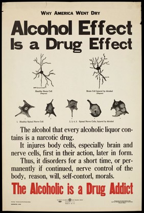 Brain and nerve cells in their healthy state and after injury by alcohol. Colour lithograph, ca. 1920.