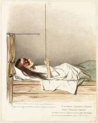 Maria Domenica Lazzari (Lazzeri), a girl with stigmata on her hands. Watercolour by L. Giuditti after L.G. de Ségur, 1846.
