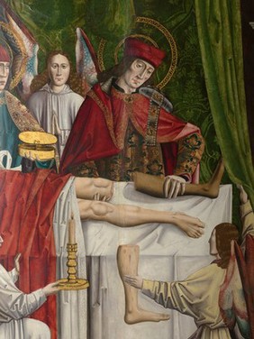 A verger's dream: Saints Cosmas and Damian performing a miraculous cure by transplantation of a leg. Oil painting attributed to the Master of Los Balbases, ca. 1495.