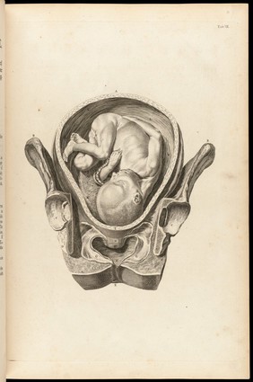 A sett of anatomical tables, with explanations, and an abridgment, of the practice of midwifery, with a view to illustrate a treatise on that subject, and collection of cases / By William Smellie, M.D.