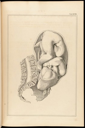 A sett of anatomical tables, with explanations, and an abridgment, of the practice of midwifery, with a view to illustrate a treatise on that subject, and collection of cases / By William Smellie, M.D.