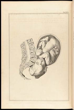 A sett of anatomical tables, with explanations, and an abridgment, of the practice of midwifery, with a view to illustrate a treatise on that subject, and collection of cases / By William Smellie, M.D.