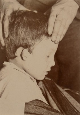 Congenital deformity of the ear