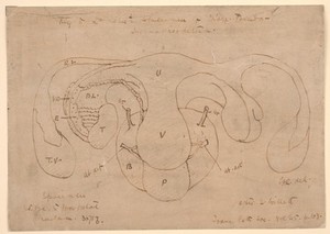 view Diagram of the pelvic organs of a man who suffered from hermaphroditism