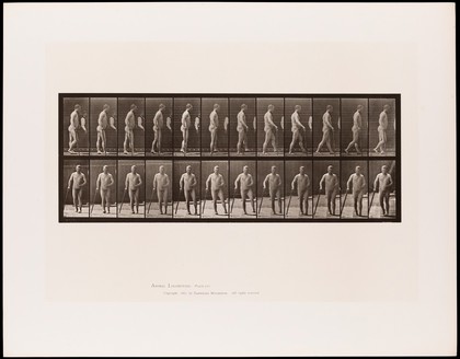 A naked man with hemiplegia walking with a stick: (above) from the side, (below) from the front. Collotype after Eadweard Muybridge, 1887.