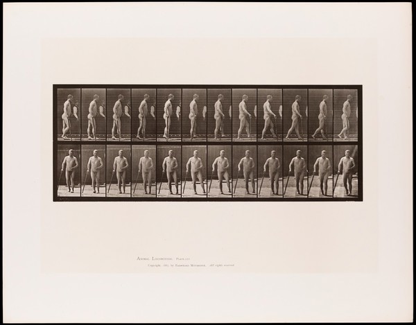 A naked man with hemiplegia walking with a stick: (above) from the side, (below) from the front. Collotype after Eadweard Muybridge, 1887.