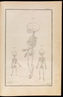 Traité d'ostéologie, traduit de l'anglois de M. Monro, professeur d'anatomie, et de la Société Royale d'Edimbourg: où l'on a ajouté des planches en taille-douce, qui représentent au naturel tous les os de l'adulte et du foetus, avec leurs explications / Par M. Sue, professeur & démonstrateur d'anatomie aux Ecoles Royales de Chirurgie.