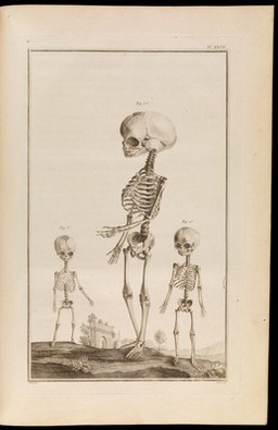 Traité d'ostéologie, traduit de l'anglois de M. Monro, professeur d'anatomie, et de la Société Royale d'Edimbourg: où l'on a ajouté des planches en taille-douce, qui représentent au naturel tous les os de l'adulte et du foetus, avec leurs explications / Par M. Sue, professeur & démonstrateur d'anatomie aux Ecoles Royales de Chirurgie.