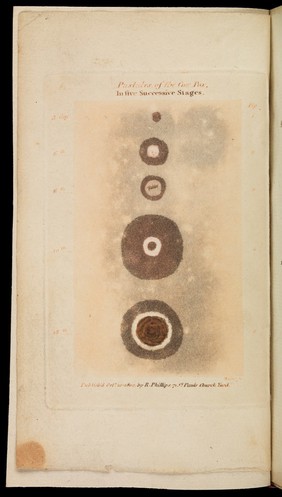 A concise view of all the most important facts which have hitherto appeared concerning the cow-pox / [Charles Rochemont Aikin].