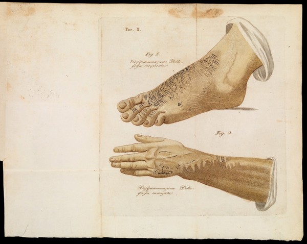 Saggio di ricerche sulla pellagra / Di Vincenzio Chiarugi.