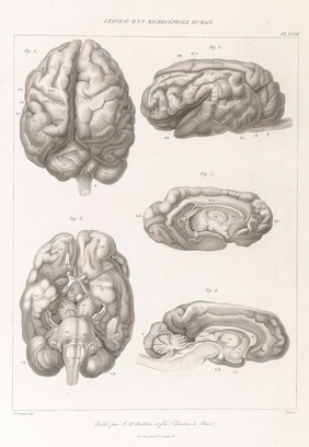 Anatomie comparée du système nerveux considéré dans ses rapports avec l'intelligence / Par Fr. Leuret et P. Gratiolet. Accompagnée d'un atlas de 32 planches dessinées d'après nature et gravées.