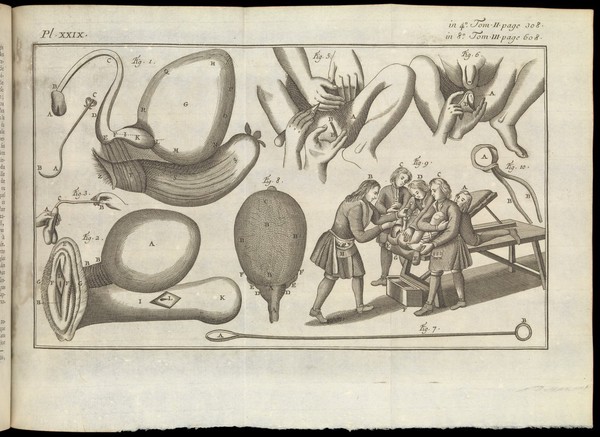 Institutions de chirurgie, où l'on traite ... de tout ce qui a rapport a cet art ... / Traduit du latin ... Avec un tableau des principales découvertes dont la chirurgie s'est enrichie depuis la dernière éd. de l'auteur en 1750, jusqu'à l'année 1770, inclusivement. Par M. Paul.