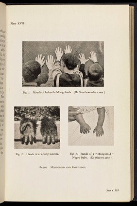 'Hands: Mongoloid and Gorilloid'.