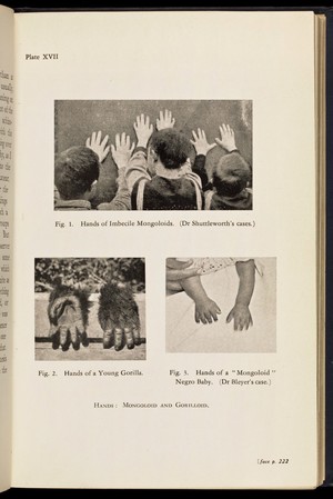 view 'Hands: Mongoloid and Gorilloid'.