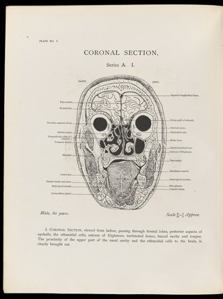 Atlas of head sections : fifty-three engraved copperplates of frozen sections of the head and fifty-three key plates with descriptive texts / by William Macewen.