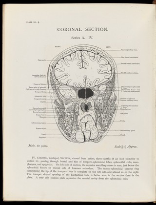 Atlas of head sections : fifty-three engraved copperplates of frozen sections of the head and fifty-three key plates with descriptive texts / by William Macewen.