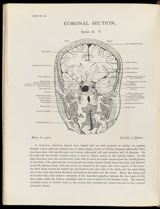 Atlas of head sections : fifty-three engraved copperplates of frozen sections of the head and fifty-three key plates with descriptive texts / by William Macewen.