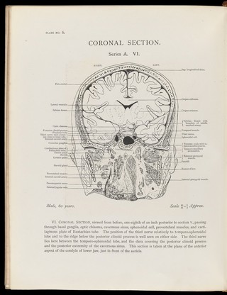 Atlas of head sections : fifty-three engraved copperplates of frozen sections of the head and fifty-three key plates with descriptive texts / by William Macewen.