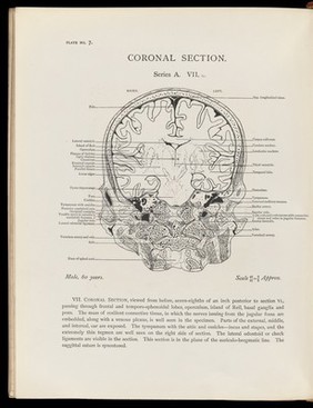 Atlas of head sections : fifty-three engraved copperplates of frozen sections of the head and fifty-three key plates with descriptive texts / by William Macewen.