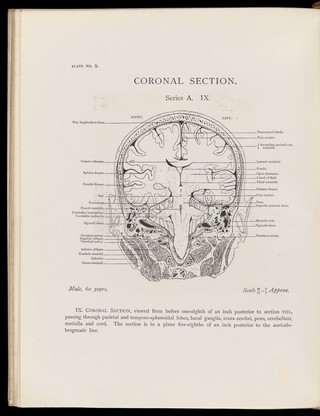 Atlas of head sections : fifty-three engraved copperplates of frozen sections of the head and fifty-three key plates with descriptive texts / by William Macewen.