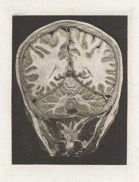 Atlas of head sections : fifty-three engraved copperplates of frozen sections of the head and fifty-three key plates with descriptive texts / by William Macewen.