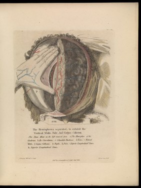 Anatomy of the heart, cranium, and brain : adapted to the purposes of the medical and surgical practitioner; to which is added, in notes, observations on the laws of life and sensation / by Alexander Ramsay.