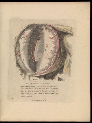 Anatomy of the heart, cranium, and brain : adapted to the purposes of the medical and surgical practitioner; to which is added, in notes, observations on the laws of life and sensation / by Alexander Ramsay.