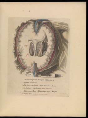 Anatomy of the heart, cranium, and brain : adapted to the purposes of the medical and surgical practitioner; to which is added, in notes, observations on the laws of life and sensation / by Alexander Ramsay.