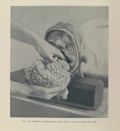 Post-mortem pathology : a manual of post-mortem examinations and the interpretations to be drawn therefrom a practical treatise for students and practitioners / by Henry W. Cattell.