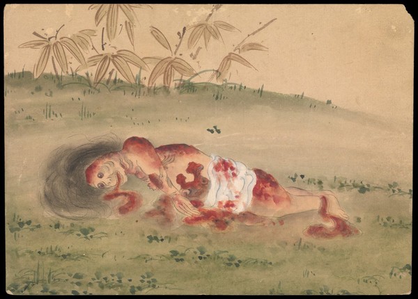 Kusōzu: the death of a noble lady and the decay of her body. Watercolours.