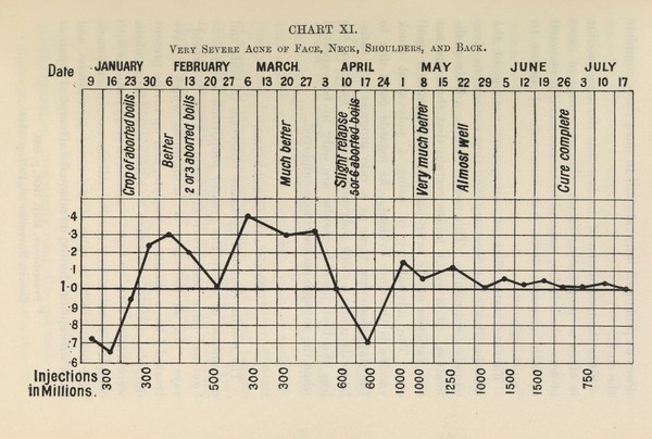 Chart indicating severity of acne after treatment. From <I>Vaccine Therapy Its Theory and Practise</I> (3rd edition).