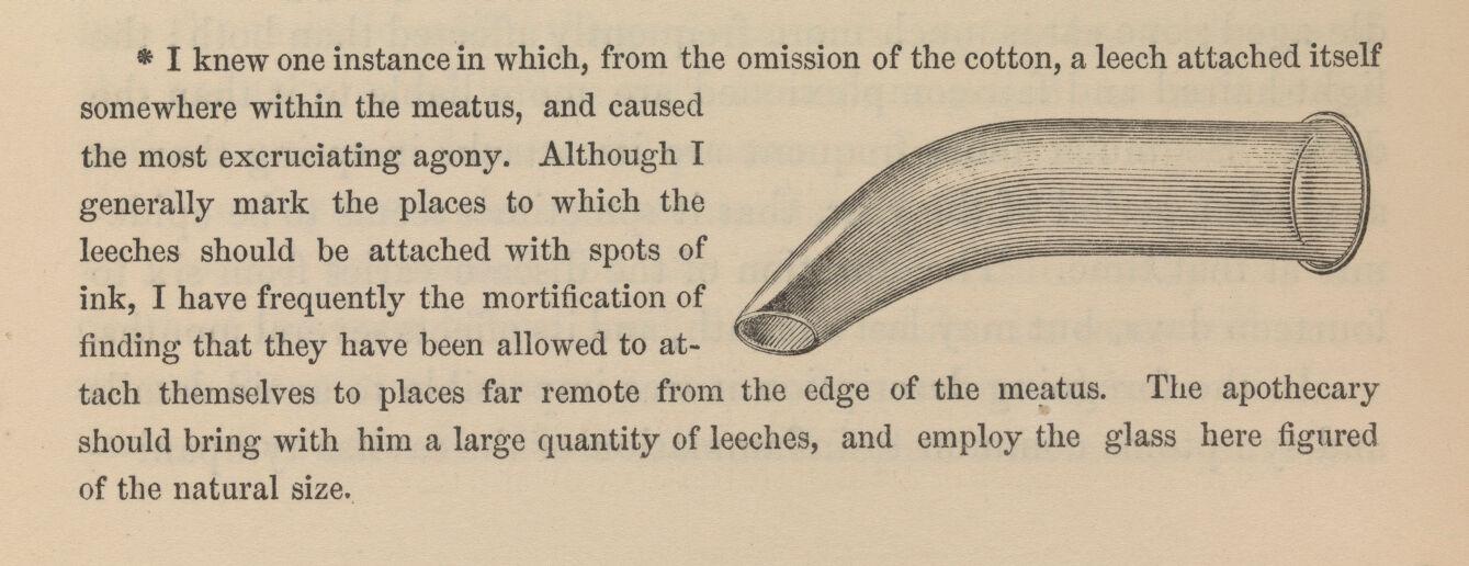 Practical observations on aural surgery and the nature and treatment of diseases of the ear / by William R. Wilde.