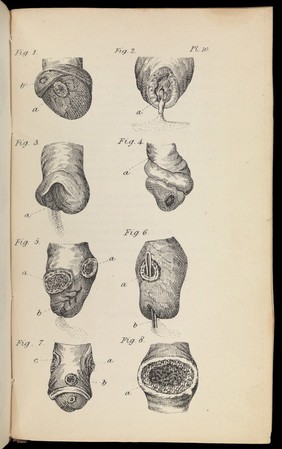 Prostitution in London, with a comparative view of that of Paris and New York ... with an account of the nature and treatment of the various diseases, caused by the abuses of the reproductive function / By Michael Ryan.