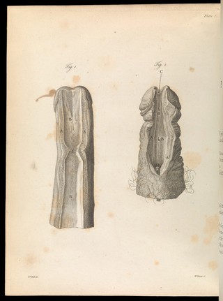 A treatise on the venereal disease / By John Hunter.