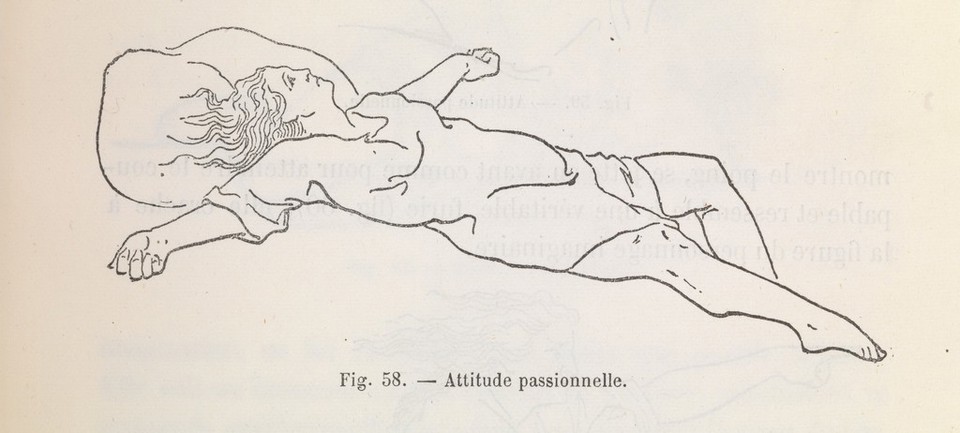 Études cliniques sur l'hystéro-épilepsie ou grande hystérie / par Paul Richer ; précédé d'une lettre-préface de J.-M. Charcot.