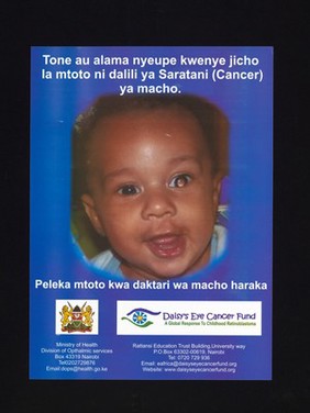 A baby with eye cancer: the daisy eye cancer fund in Kenya. Colour lithograph by the Ministry of Health and Rattansi Education Trust, ca. 2000.