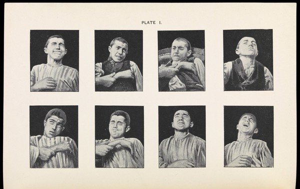 The Physiognomy of Pain, Plate I, Fear by A. Mosso