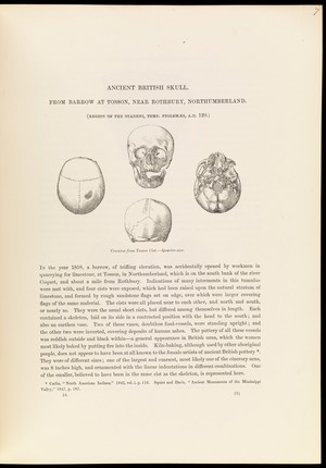 view Four sketches of an ancient British skull