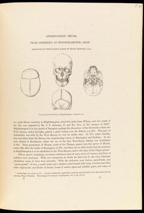 Four sketches, from different angles, of an Anglo-Saxon skull, from cemetery at Brighthampton, Oxon (Kingdom of the West-Saxons, Sixth to Tenth Century A.D)