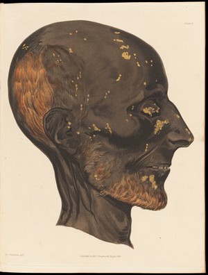 view Profile view of a mummified male head