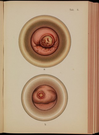 Atlas of syphilis and the veneral diseases : including a brief treatise on the pathology and treatment / by Prof. Dr. Franz Mraček, edited by L. Bolton Bangs.