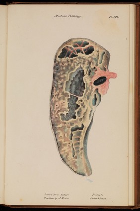 Illustrations of pulmonary consumption, its anatomical characters, causes, symptoms and treatment. With twelve plates, drawn and coloured from nature / By Samuel George Morton.