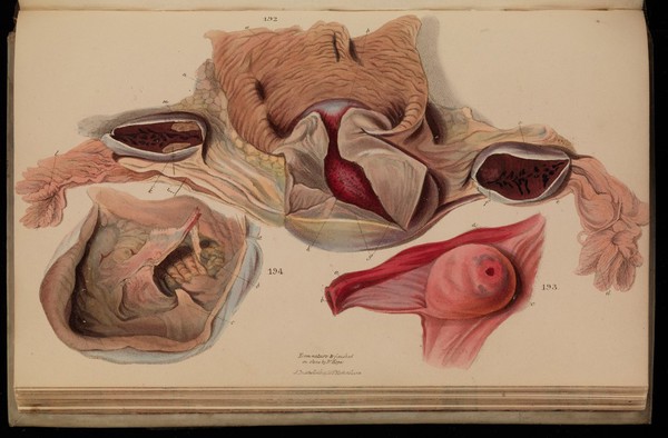 Principles and illustrations of morbid anatomy; adapted to the elements of M. Andral, and to the Cyclopaedia of practical medicine ... / being a complete series of coloured lithographic drawings from originals by the author; with descriptions and summary allusions to cases, symptoms, treatment, &c. ... By J. Hope.