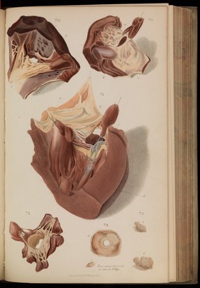 Principles and illustrations of morbid anatomy; adapted to the elements of M. Andral, and to the Cyclopaedia of practical medicine ... / being a complete series of coloured lithographic drawings from originals by the author; with descriptions and summary allusions to cases, symptoms, treatment, &c. ... By J. Hope.