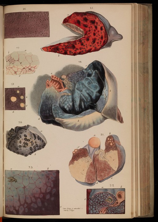 Close-ups of various kinds of pathology affecting the tissues
